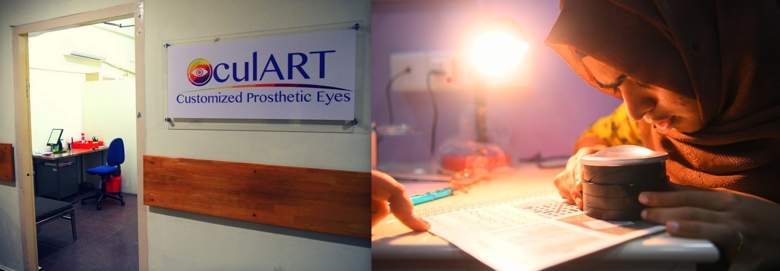 Ocular Prosthetic Clinic